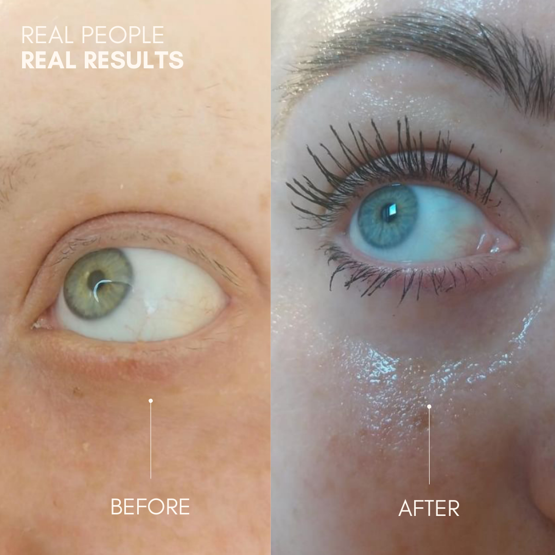 Lash Growth Serum by Amoria